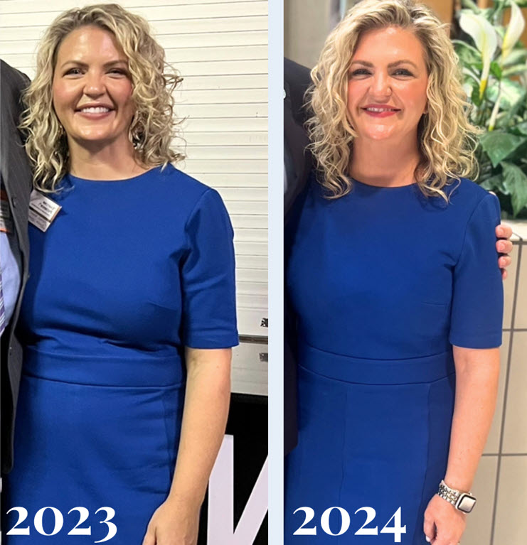 Tummy Tuck Surgery Raleigh