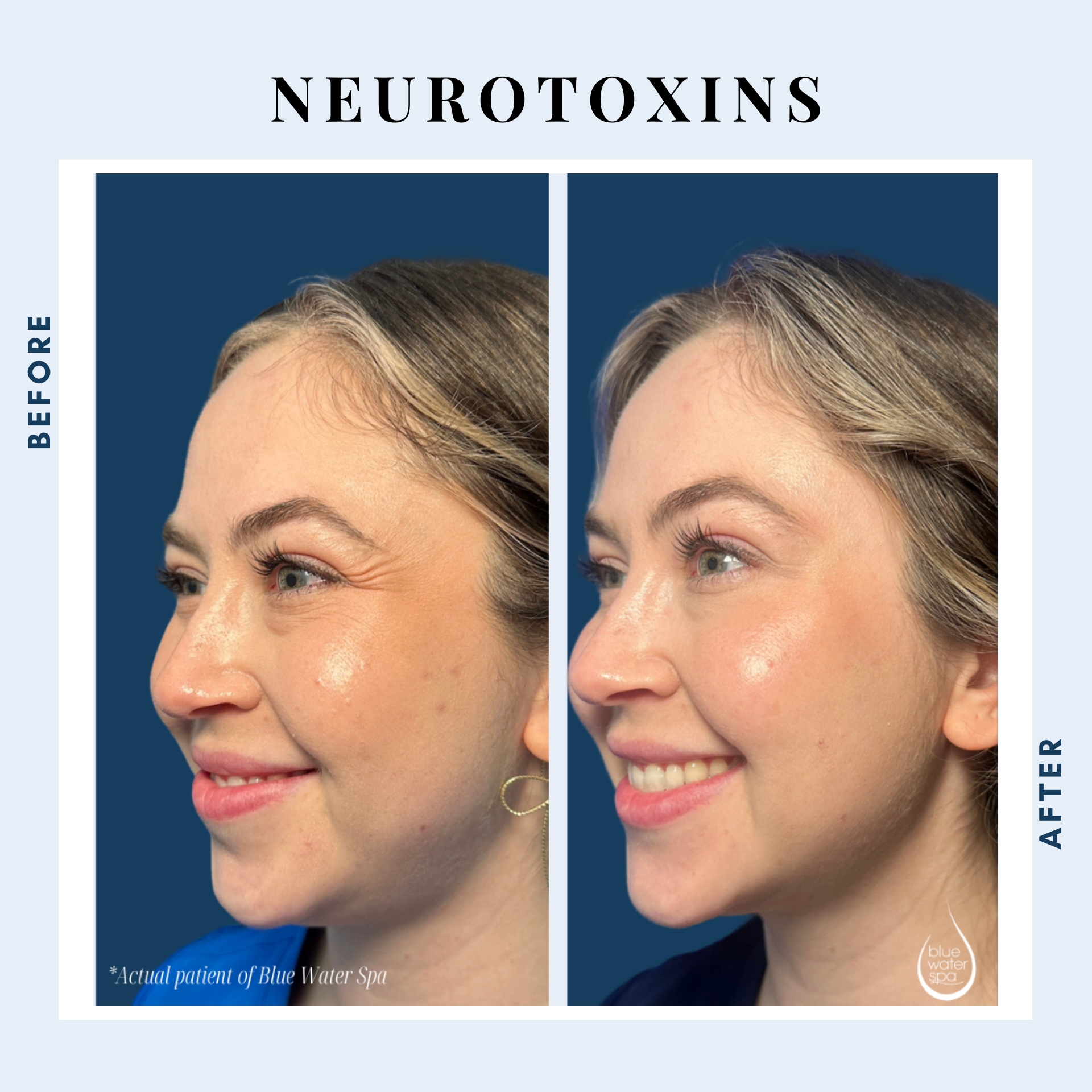 Neuromodulators
